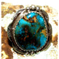 Massive Navajo Morenci Turquoise Ring Sz 9 Adjustable Adam